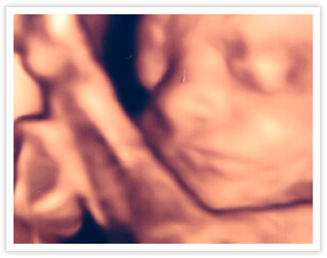 pregnant woman holding 3d ultrasound photo